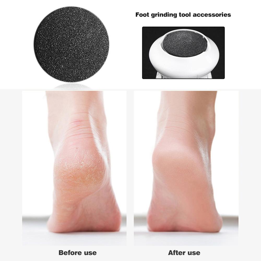 ELECTRIC CALLUS REMOVER FOR FEETS